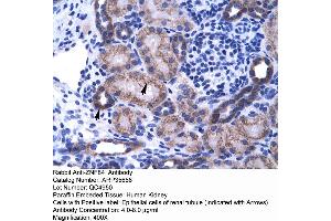 Human kidney (ZNF84 antibody  (C-Term))
