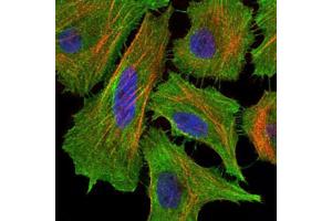 Immunofluorescence analysis of Hela cells using FAS antibody (green). (FAS antibody)