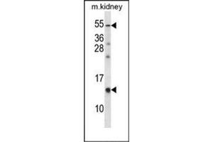 Western blot analysis of RAMP3 Antibody  in Mouse kidney tissue lysates (35ug/lane). (RAMP3 antibody  (C-Term))