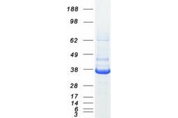 SRR Protein (Myc-DYKDDDDK Tag)
