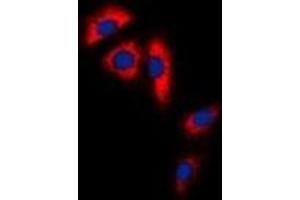 Immunofluorescent analysis of Aconitase 1 staining in Hela cells. (Aconitase 1 antibody  (N-Term))