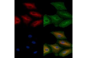 ABIN6264551 and ABIN6272407 staining  cells by IF/ICC. (RAB11FIP4 antibody  (Internal Region))