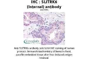 Image no. 2 for anti-SLIT and NTRK-Like Family, Member 6 (SLITRK6) (Internal Region) antibody (ABIN1739441) (SLITRK6 antibody  (Internal Region))