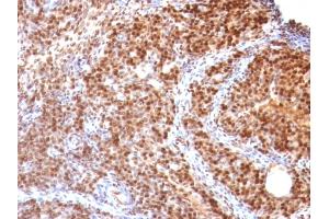 SUMO2 antibody