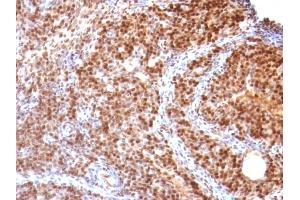 Formalin-fixed, paraffin-embedded Rat Ovary stained with SUMO-2 MAb (SUMO2/1199)