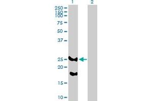 Western Blot analysis of REEP2 expression in transfected 293T cell line by REEP2 MaxPab polyclonal antibody. (REEP2 antibody  (AA 1-252))