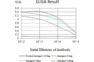 Black line: Control Antigen (100 ng),Purple line: Antigen (10 ng), Blue line: Antigen (50 ng), Red line:Antigen (100 ng) (SIRT2 antibody  (AA 275-389))