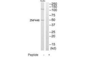 Western blot analysis of extracts from HuvEc cells, using ZNF446 antibody. (ZNF446 antibody)