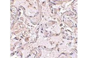 Immunohistochemical staining of human lung tissue using AP30389PU-N GSTP1 antibody at 2.