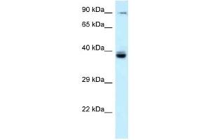Western Blot showing TAGAP antibody used at a concentration of 1 ug/ml against Fetal Liver Lysate (TAGAP antibody  (N-Term))