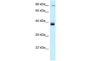 Western Blot showing TAGAP antibody used at a concentration of 1 ug/ml against Fetal Liver Lysate
