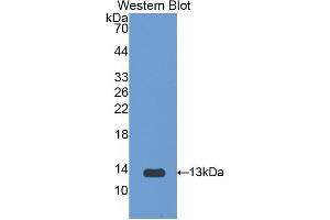 Western blot analysis of the recombinant protein. (IL1R1 antibody  (AA 119-217))