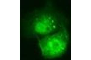 Anti-C21orf59 mouse monoclonal antibody (ABIN2452866) immunofluorescent staining of COS7 cells transiently transfected by pCMV6-ENTRY C21orf59 (RC200169). (C21orf59 antibody)