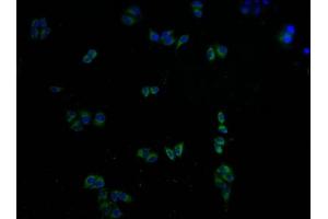 Immunofluorescence staining of Hela cells with ABIN7146439 at 1:100, counter-stained with DAPI. (CAMK2A antibody  (AA 321-478))