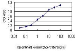 Detection limit for recombinant GST tagged ACE is approximately 0. (Angiotensin I Converting Enzyme 1 antibody  (AA 592-701))
