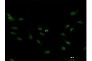 Immunofluorescence of monoclonal antibody to FOXM1 on HeLa cell. (FOXM1 antibody  (AA 22-110))