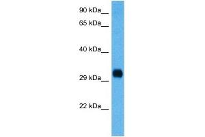 Host:  Mouse  Target Name:  CCND3  Sample Tissue:  Mouse Spleen  Antibody Dilution:  1ug/ml (Cyclin D3 antibody  (C-Term))