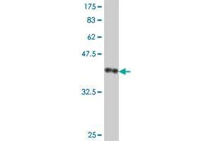 Western Blot detection against Immunogen (37. (STS antibody  (AA 248-350))