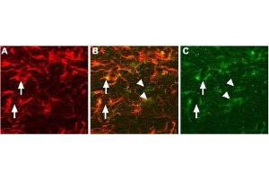 Expression of proNGF in rat brain sections - Immunohistochemical staining of proNGF in rat brain sections using Anti-proNGF Antibody (ABIN7043556, ABIN7044751 and ABIN7044752). (Nerve Growth Factor antibody  (Pro-Domain))