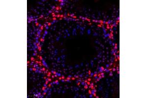 Immunofluorescence of paraffin embedded mouse testis using smad62024 (ABIN7075629) at dilution of 1:1000 (300x lens) (SMAD6 antibody)