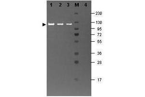 Western blotting using  Fluorescein conjugated anti-b-Galactosidase antibody shows a band at ~117 kDa (lanes 1 - 3) corresponding to 60 ng, 30 ng and 15 ng, respectively of b-Gal present in partially purified preparations (arrowhead). (GLB1 antibody  (FITC))