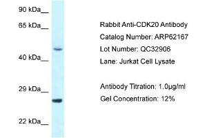 Western Blotting (WB) image for anti-Cyclin-Dependent Kinase 20 (CDK20) (N-Term) antibody (ABIN2789044) (CCRK antibody  (N-Term))