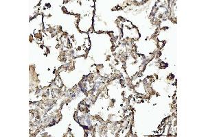 IHC analysis of Annexin VI/ANXA6 using anti-Annexin VI/ANXA6 antibody (ABIN5692982). (ANXA6 antibody  (AA 395-665))