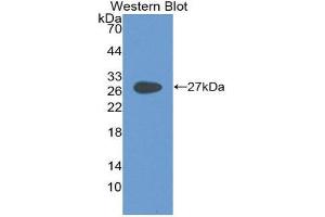Western Blotting (WB) image for anti-Glycoprotein 2 (Zymogen Granule Membrane) (GP2) (AA 307-512) antibody (ABIN2118694) (GP2 antibody  (AA 307-512))
