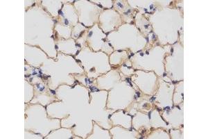 IHC testing of FFPE mouse lung tissue with Csf1r antibody at 1:25 dilution. (CSF1R antibody  (AA 895-923))