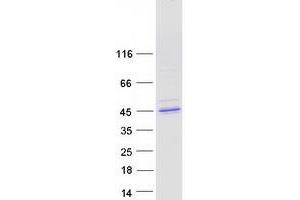 CELF5 Protein (Transcript Variant 2) (Myc-DYKDDDDK Tag)