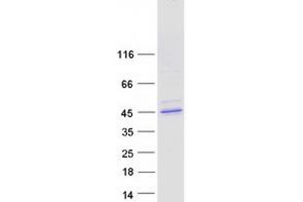 CELF5 Protein (Transcript Variant 2) (Myc-DYKDDDDK Tag)