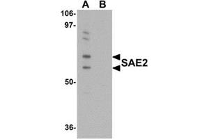 Western blot analysis of SAE2 in 293 cell lysate with SAE2 antibody at 0.