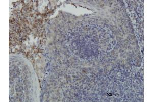 Immunoperoxidase of monoclonal antibody to RPS6KA6 on formalin-fixed paraffin-embedded human tonsil. (RPS6KA6 antibody  (AA 636-745))