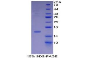 SDS-PAGE analysis of Human Inhibin beta B Protein.