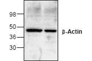 Image no. 1 for anti-Actin, beta (ACTB) antibody (ABIN127292) (beta Actin antibody)