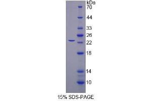 Image no. 1 for Splicing Factor 3b, Subunit 3, 130kDa (SF3B3) (AA 35-210) protein (His tag) (ABIN4990991) (SF3B3 Protein (AA 35-210) (His tag))