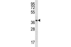 PSMA1 antibody western blot analysis in A2058 lysate.