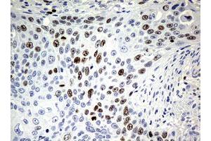 Image no. 1 for anti-Antigen Identified By Monoclonal Antibody Ki-67 (MKI67) (AA 1160-1493) antibody (ABIN1490857) (Ki-67 antibody  (AA 1160-1493))