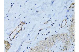 Immunohistochemistry of paraffin-embedded human colon using MCAM antibody (ABIN6290150) at dilution of 1:100 (40x lens). (MCAM antibody)