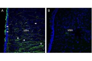 Expression of Semaphorin 4A in rat hypothalamus - Immunohistochemical staining of perfusion-fixed frozen rat brain sections with Anti-Semaphorin 4A (SEMA4A) (extracellular) Antibody (ABIN7043610, ABIN7045300 and ABIN7045301), (1:300), followed by goat anti-rabbit-Alexa-488. (Sema4a antibody  (Extracellular, N-Term))