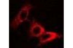 Immunofluorescent analysis of Pyridoxal Kinase staining in U2OS cells. (PDXK antibody)
