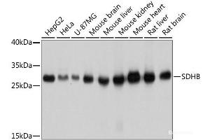 SDHB antibody