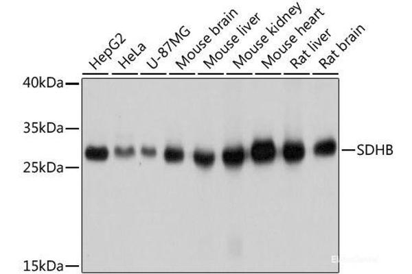 SDHB antibody