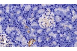 Immunohistochemistry (IHC) image for anti-Keratin 5 (KRT5) (AA 335-473) antibody (ABIN7437212)