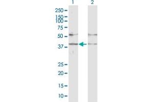 Lane 1: GABPB2 transfected lysate ( 42. (GABPB2 293T Cell Transient Overexpression Lysate(Denatured))
