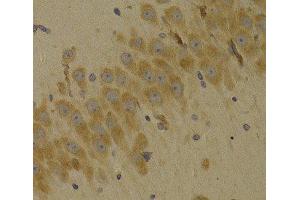 Immunohistochemistry of paraffin-embedded Rat brain using SCO2 Polyclonal Antibody at dilution of 1:100 (40x lens). (SCO2 antibody)