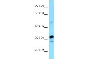 WB Suggested Anti-Nrbf2 Antibody Titration: 1. (NRBF2 antibody  (N-Term))