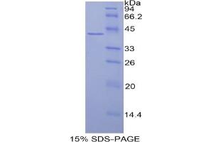 SDS-PAGE analysis of Human Histone Cluster 3, H2a Protein.
