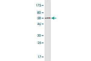 Western Blot detection against Immunogen (61. (PRMT6 antibody  (AA 1-316))