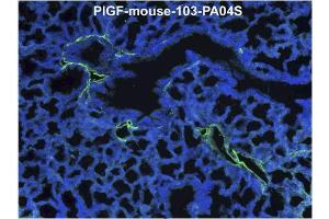 Immunofluorescence staining (green) of mouse lung tissue (ED18) with anti-Mouse PlGF Antibody Cat.